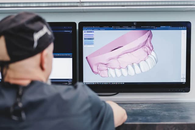 Implanty Szczecin gdzie najlepiej – wybierz klinikę z najwyższą jakością